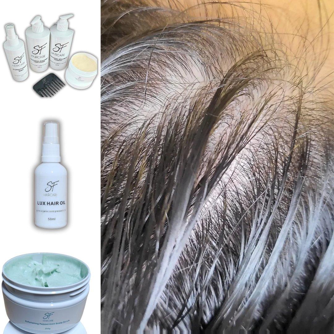 The Importance of Scalp Care: How to Nourish Your Scalp for Healthier Hair - SFHaircare