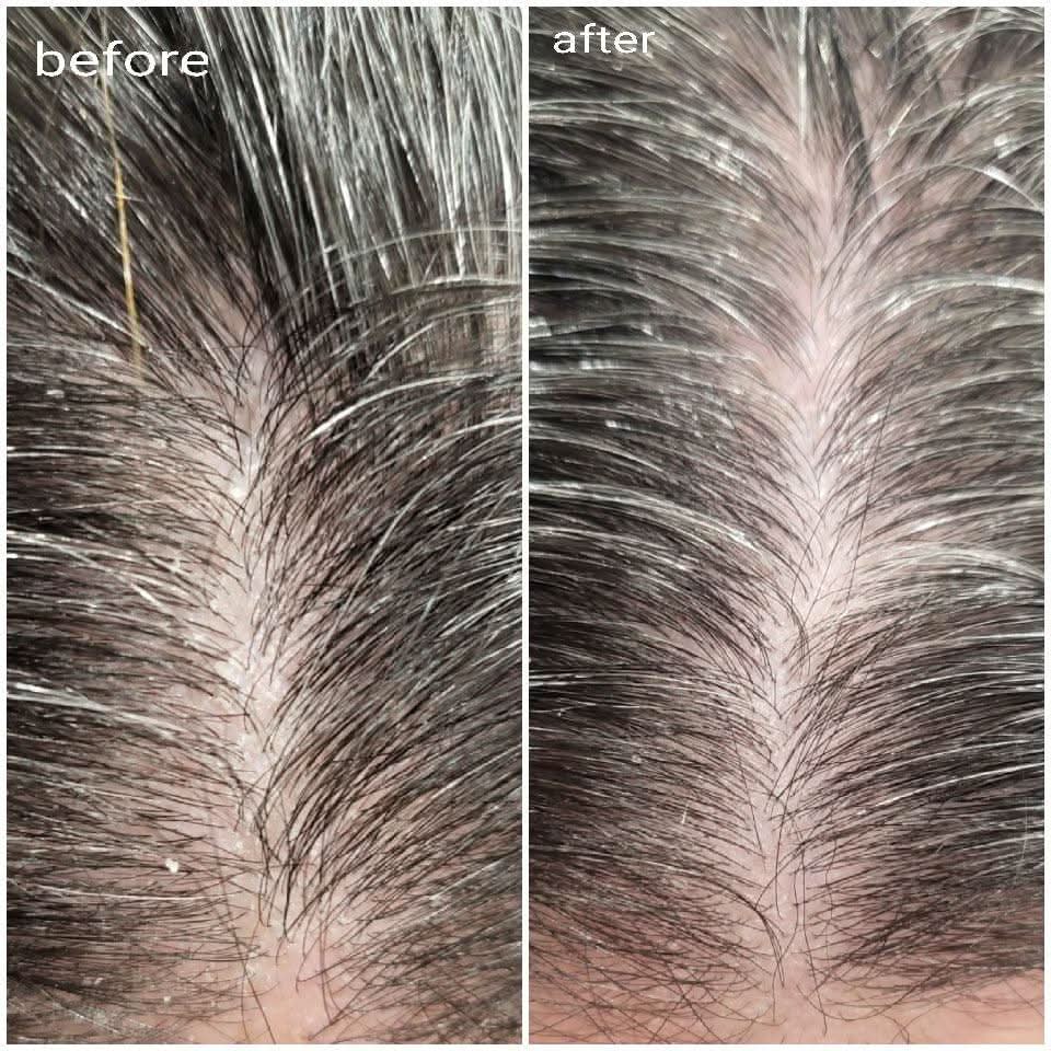 Duo Refill Bundle Shampoo 500ml & Conditioner 500ml ♻ - SFHaircare