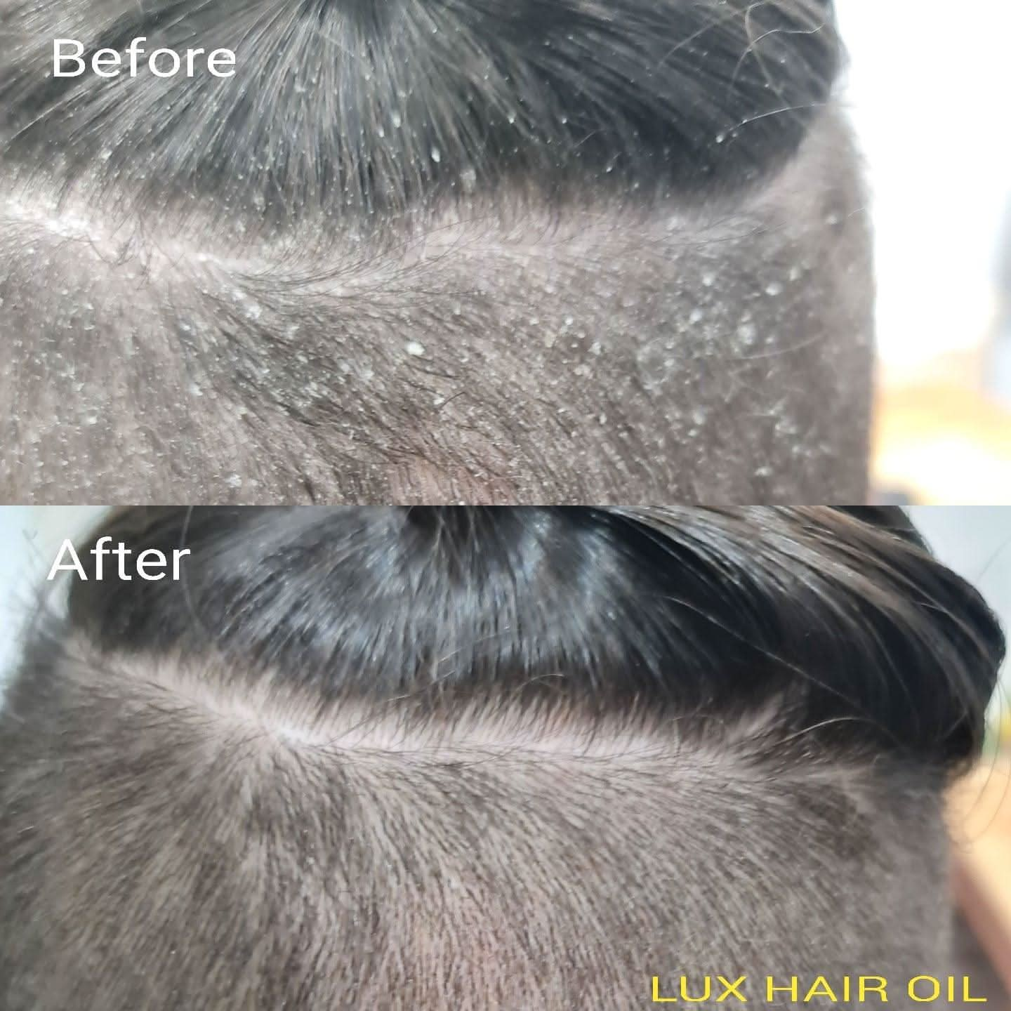 Lux Hair Oil - SFHaircare